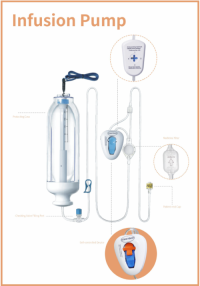 Infusion Pump